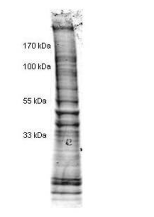 Coomassie stained SDS-PAGE of 25 μg of Etoposide stimulated Human Derived Hela Cell Nuclear Extract (Ready-to-Use) separated in a 4-20% gradient gel under non-reducing conditions. Molecular weight standards are shown on the left.